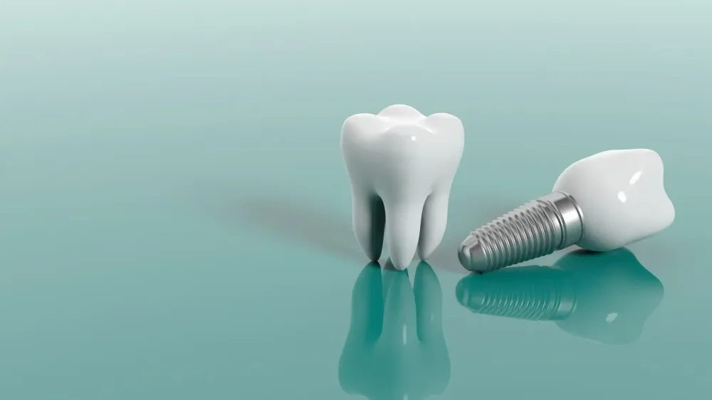 Dental implants in Costa Rica